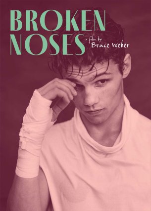 Broken Noses